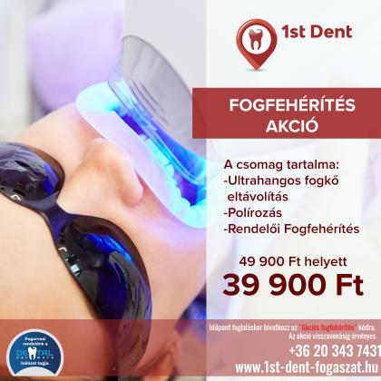 Fogfehérítés AKCIÓ Fogfehérítés AKCIÓ