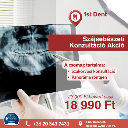 Szájsebészeti Konzultáció Akció Szájsebészeti Konzultáció Akció