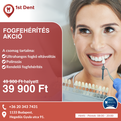 Fogfehérítés Akció Fogfehérítés Akció