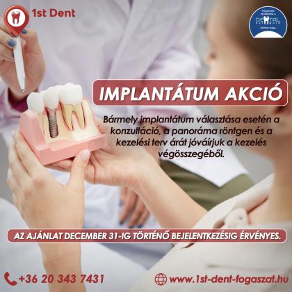 Implantátum Akció Implantátum Akció