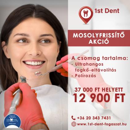 Mosolyfrissítő Akció