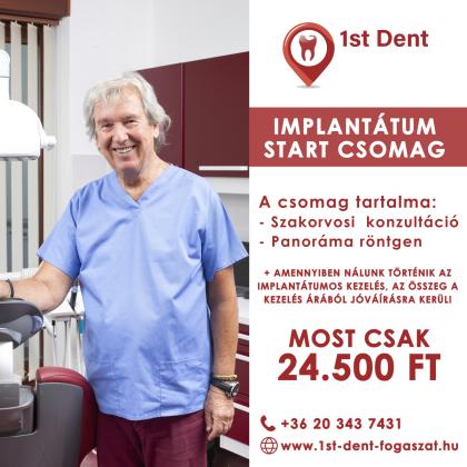 Implantátum Start Csomag